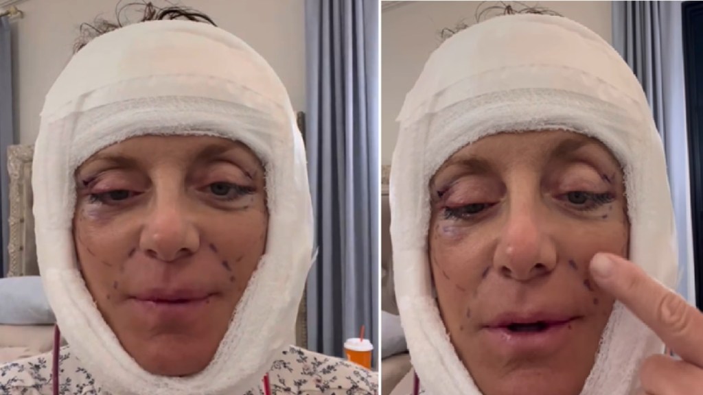 Бывшая участница реалити-шоу "RHONJ" Кэти Вакиле шокировала поклонников перевязанным лицом: подробности.