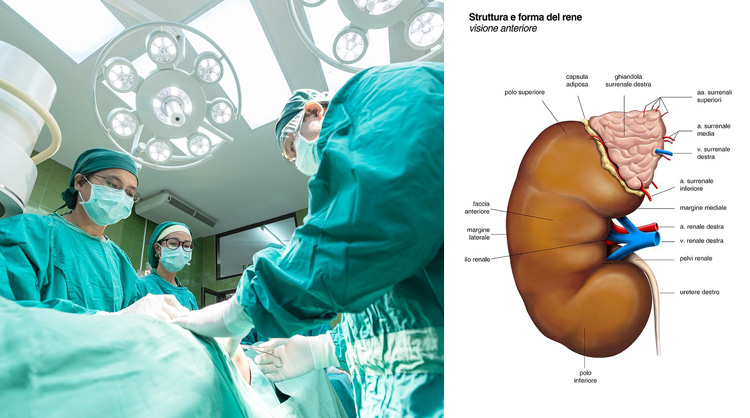 Nierentransplantation